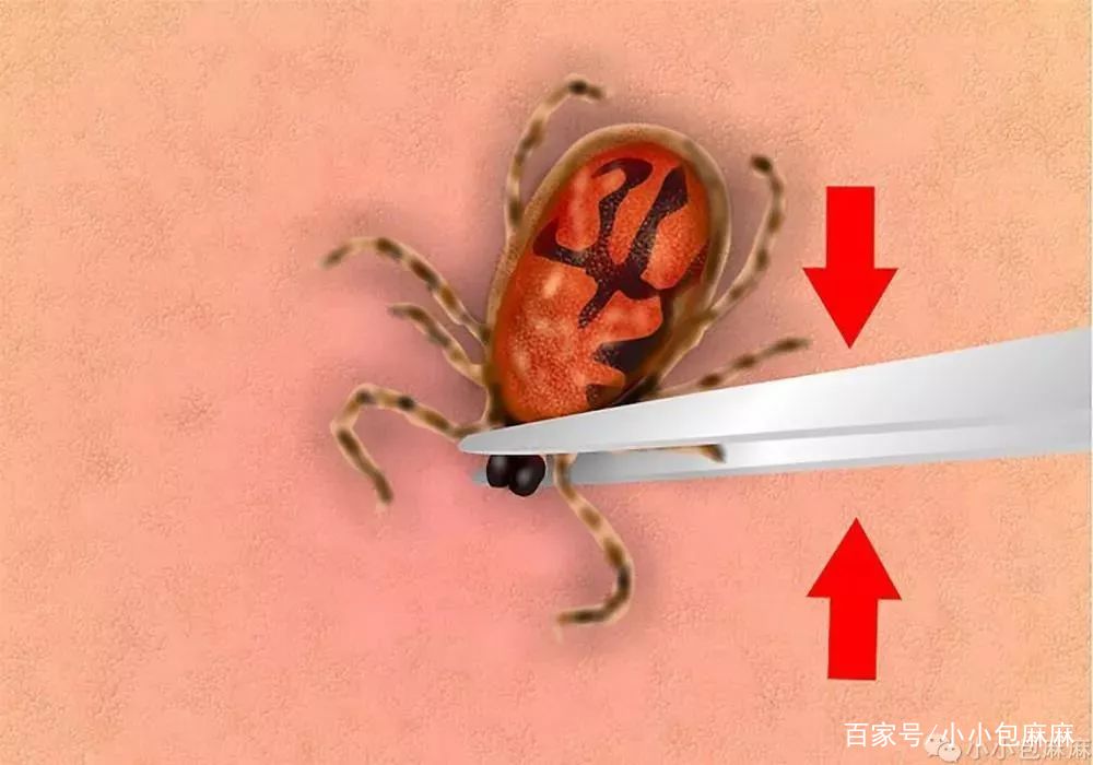                     1月之内3人身亡，宝宝身上出现这种“小黑痣”别大意！