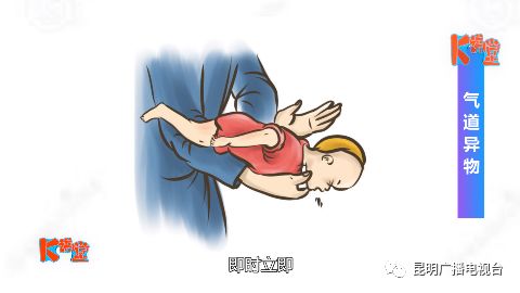 视频| 《k讲堂 儿科专家来了》什么是气道异物?