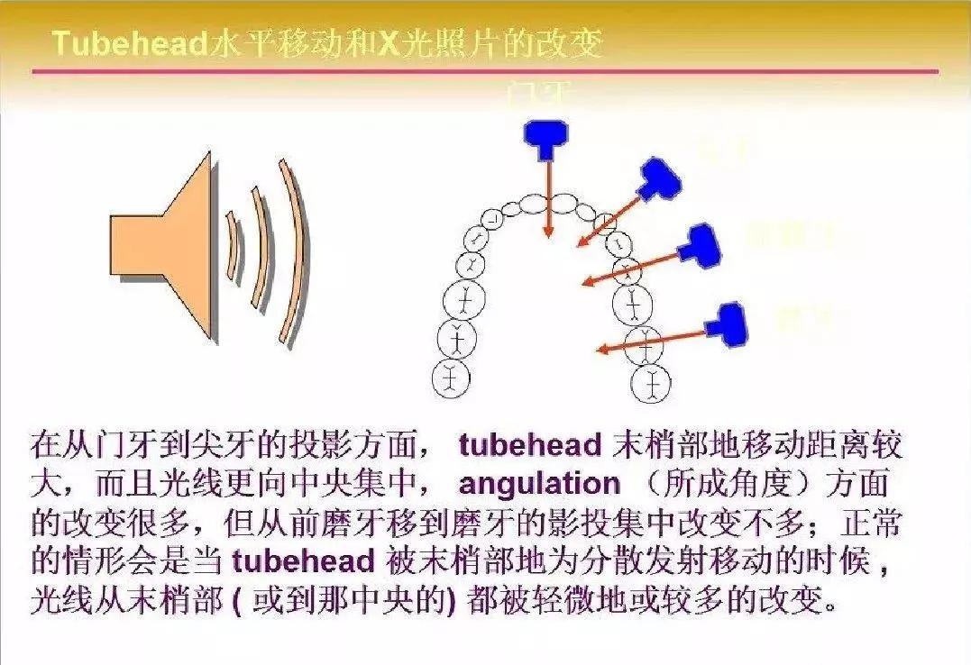 拍根尖片的技巧