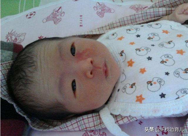                     新生儿有“胎记”，妈妈很揪心，这五种胎记是在孕期埋下的根！