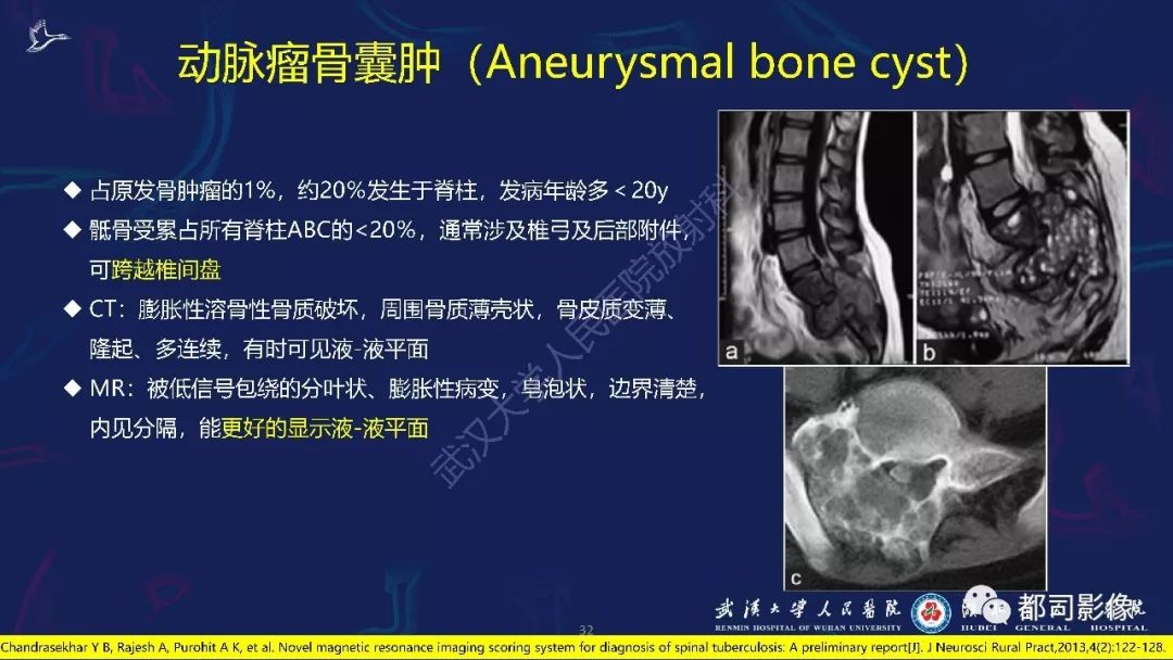 骶尾部肿瘤及肿瘤样病变影像诊断