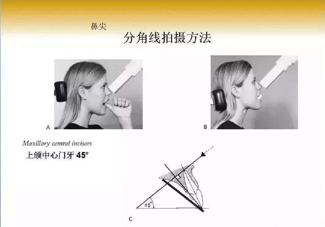 拍根尖片的技巧