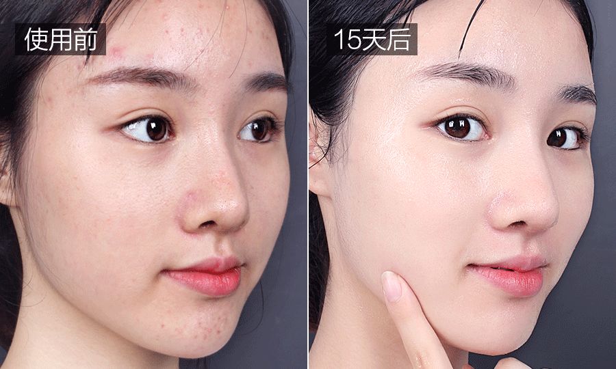 什么可以美白脸 0386136cc9ab4a30991961652866e73e.jpeg