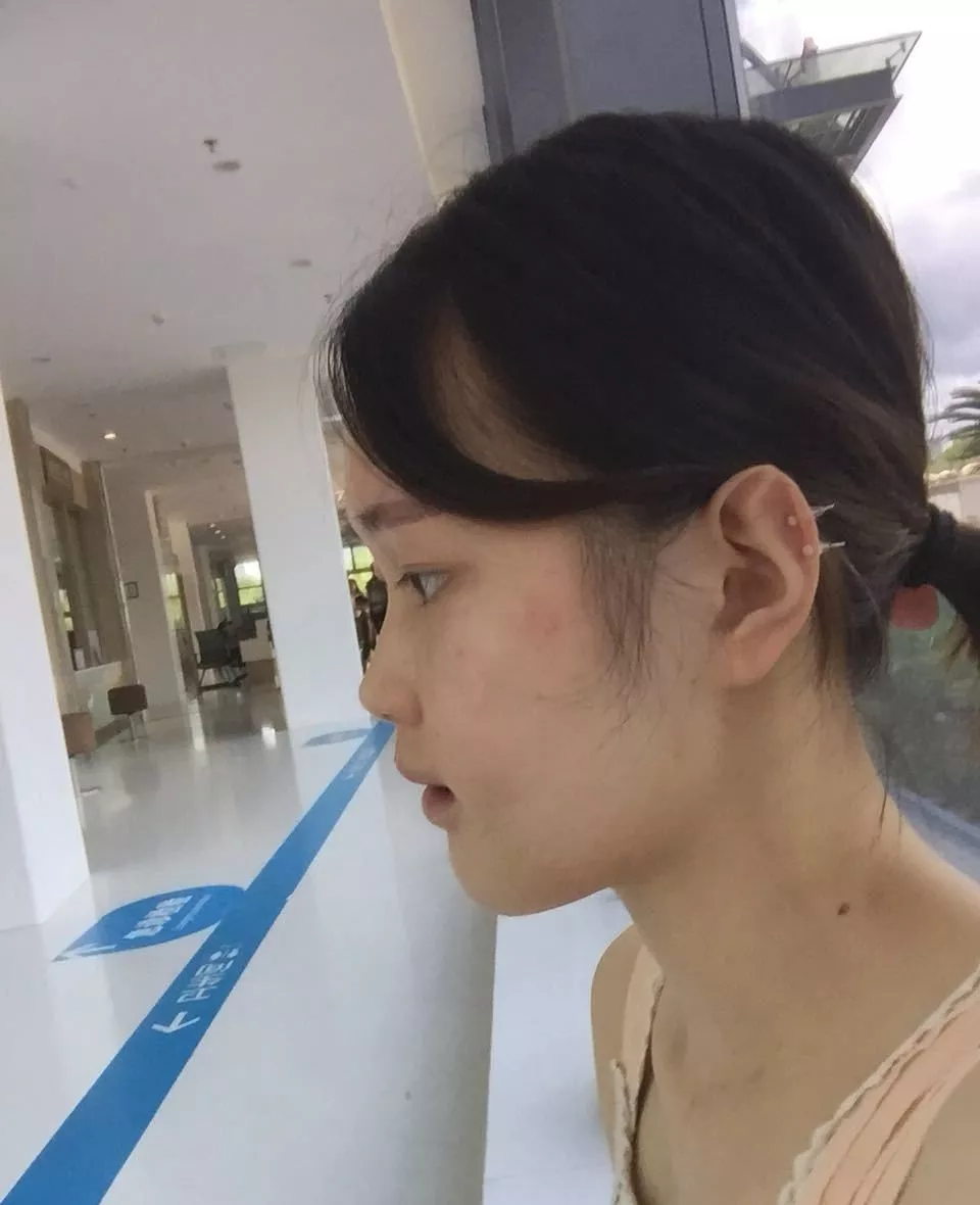19933b492a54425ab76554eb901f17a6.png