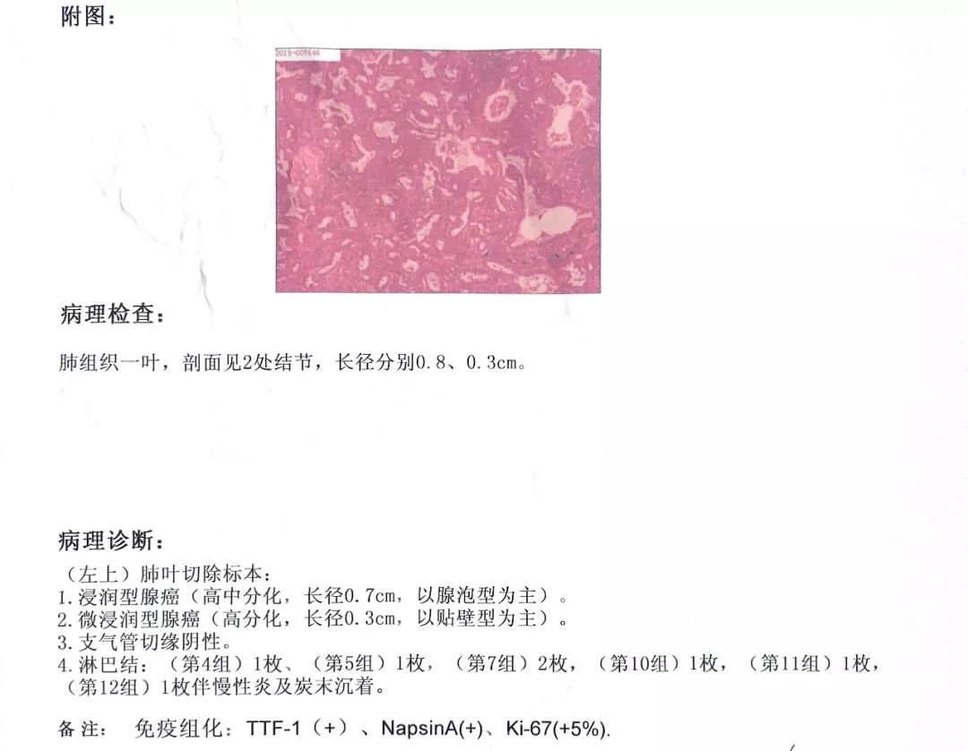 王女士的病理报告