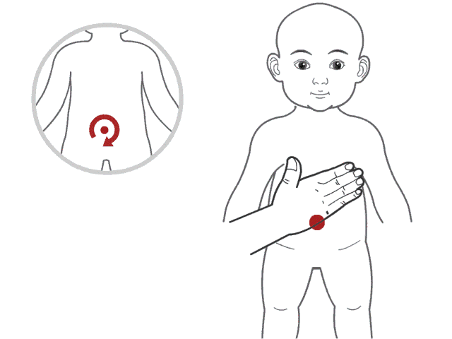                    怎么辨别孩子的前期积食？快看看你家孩子的鼻梁有青筋吗？