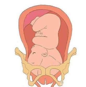 怎么快速入盆帮助顺产 73d55961fa9f4312b2dd65c50143f179.jpeg