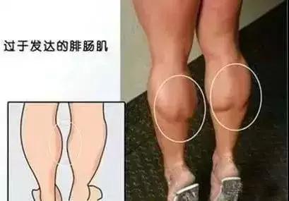 跑步后小腿变粗怎么办