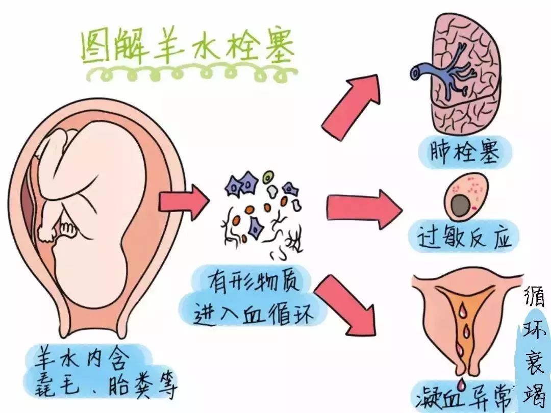 人口太多了_紧急提醒 很多新昌人爱吃的它又出事了 一高三考生(3)