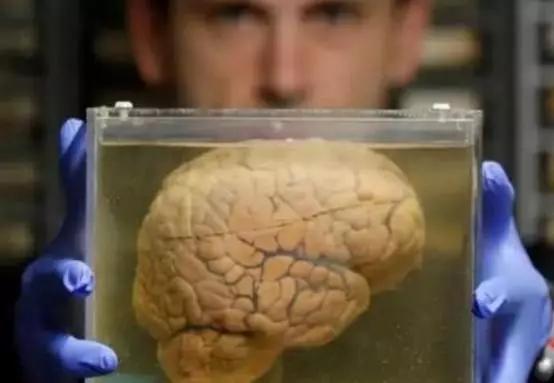 曾偷走"爱因斯坦大脑"的人,40多年过去,如今他研究出了什么