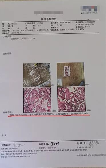 子宫异常出血1年结果是