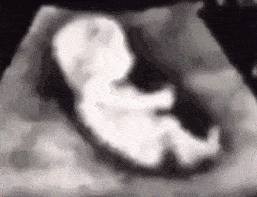 580f11c2ecef48f1876e700a884c8e64.gif