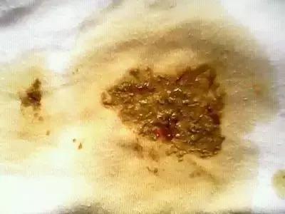                     奶瓣、绿便、腹泻、便秘...宝宝的各种便便真图全解！建议收藏~
