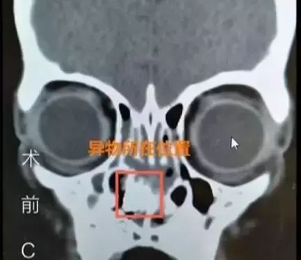 小孩子做ct有什么坏处 9fde49ebc0b34cccab368cd2bea50306.jpeg