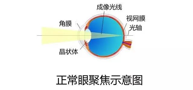 人均近视度数_近视度数对照表