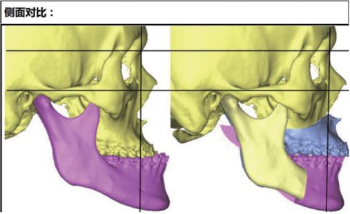 口腔颌面外科排名_口腔颌面外科(3)