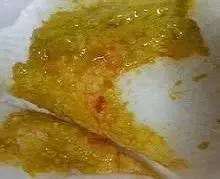                     奶瓣、绿便、腹泻、便秘...宝宝的各种便便真图全解！建议收藏~