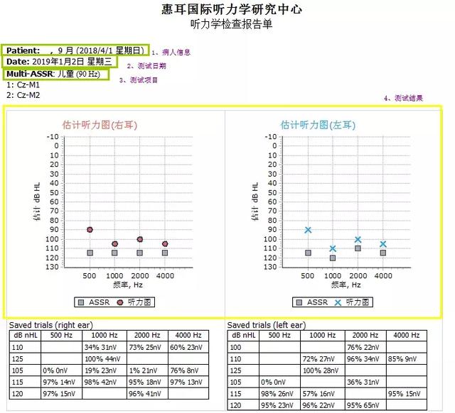 宝妈宝爸如何看懂听力学电生理报告?(二)