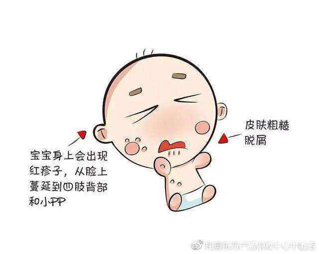                     新如何判断新生儿湿疹？宝宝患湿疹后应该如何护理？