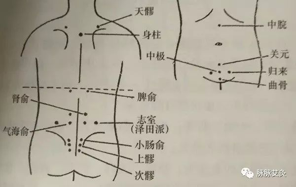 日本针灸大师子宫肌瘤必灸穴五柱穴