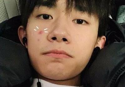 原创tfboys生图曝光王源痘痘肌王俊凯青春痘而千玺有痘坑