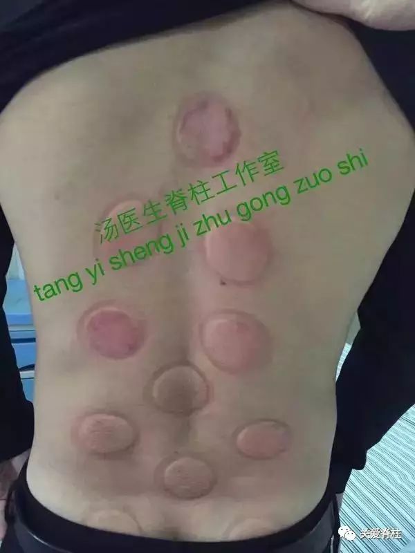 cffbdcc5395a4ec386b1eef73f617222.jpeg
