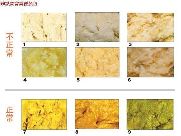                     宝宝大便次数，颜色，形状对照，来看下你家孩子的便便是否正常