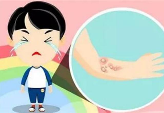                     3岁小孩被开水烫伤，妈妈的紧急处理方法，连医生都夸赞