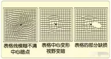 健康一张图测痴呆脑梗视力50岁后每年都要测太实用了