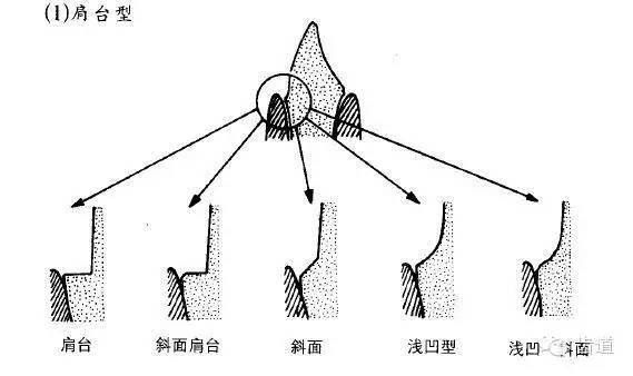 基牙具有良好的抗力形 l保留活髓及其整体性 l保留较多的牙体组织 l