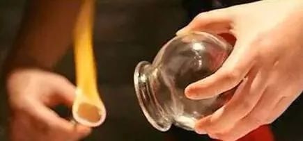 拔罐后的罐印都暗示了什么