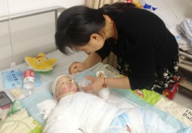                     3岁小孩被开水烫伤，妈妈的紧急处理方法，连医生都夸赞