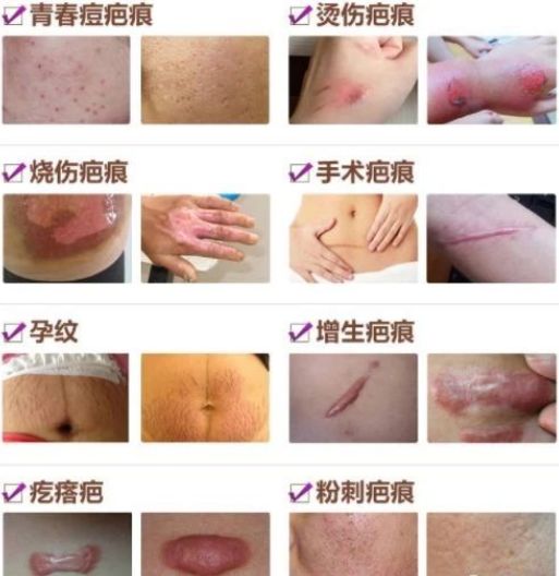 e86dd1cb55244dbf80cc988b6d813fb4.jpeg