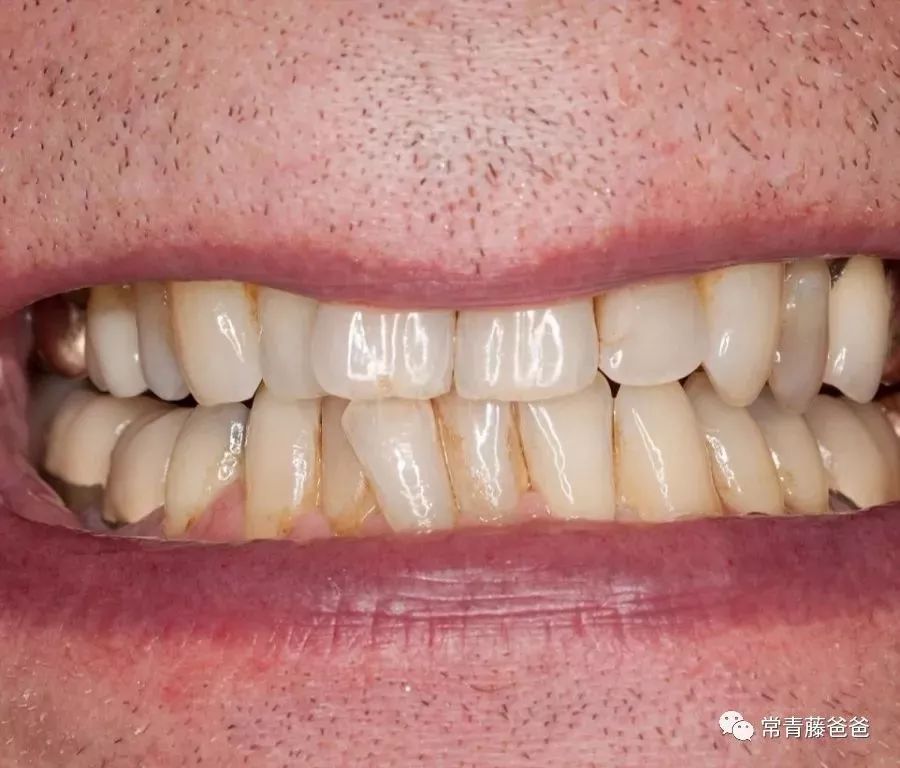                     孩子不爱刷牙？把这些图片给孩子看，拦都拦不住！