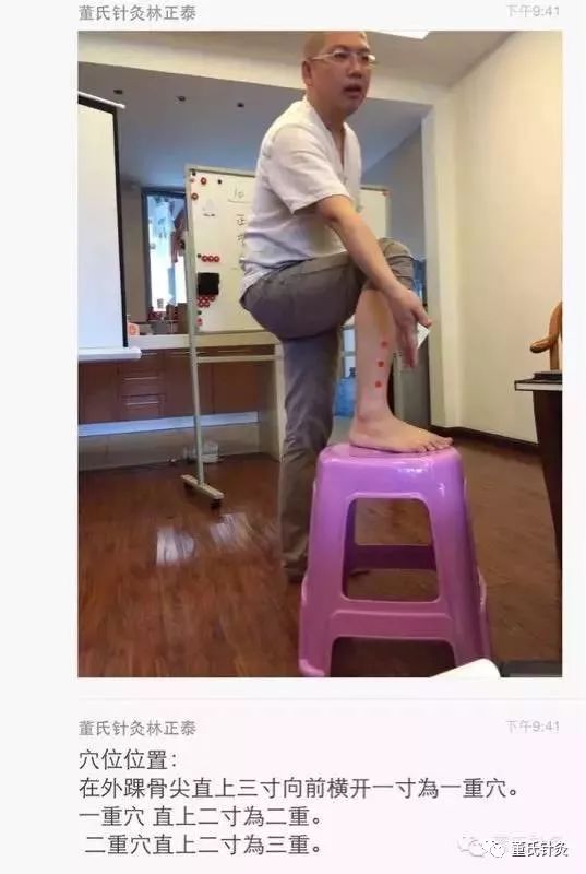 董氏针灸林正泰案例分享之 三重穴 治疗