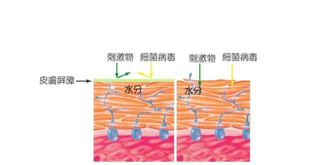 角质层过薄怎么办