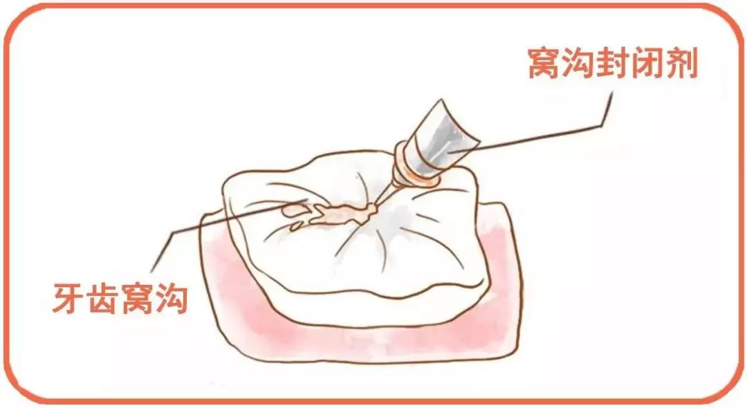成语闭什么羞_羞羞的铁拳(3)