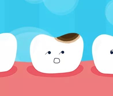 【儿牙护理】儿童蛀牙发病率为70%,家长要怎么办?