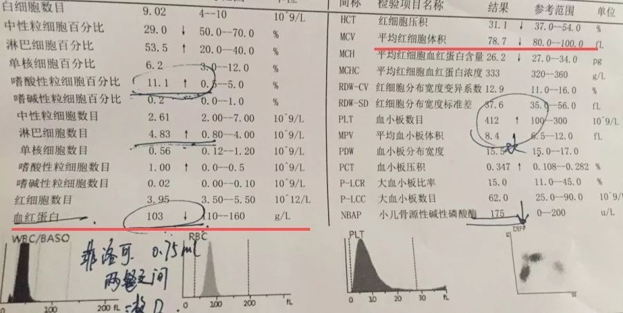                     宝宝贫血是什么原因？该吃什么药？吃什么辅食？一篇全搞懂！