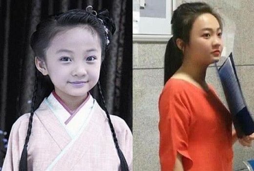                     原创            为什么孩子小时候很可爱，长大后却越来越丑了？3个变丑的原因
