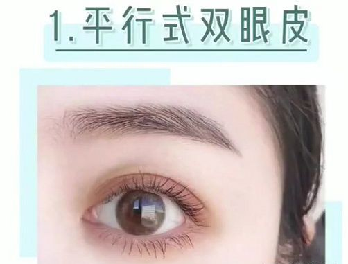 双眼皮一般分为平行式双眼皮,新月型双眼皮,开扇形双眼皮,欧式型双