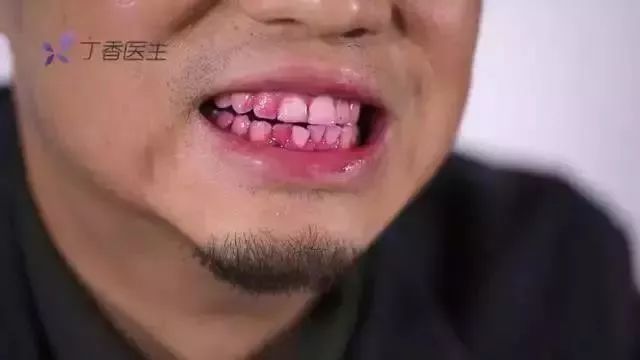                     孩子不爱刷牙？把这些图片给孩子看，拦都拦不住！