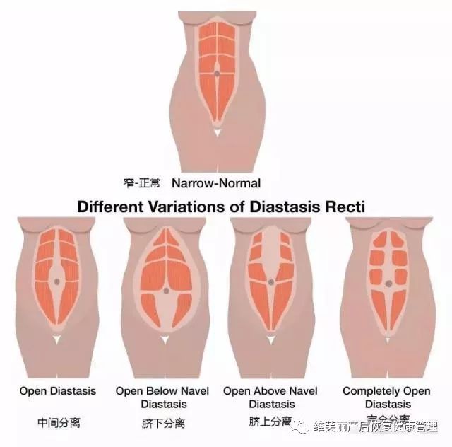 骨盆修复的原理_仪器骨盆修复和徒手的哪个更适合 看完这篇文章你就知道了(3)