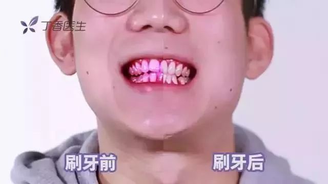                     孩子不爱刷牙？把这些图片给孩子看，拦都拦不住！