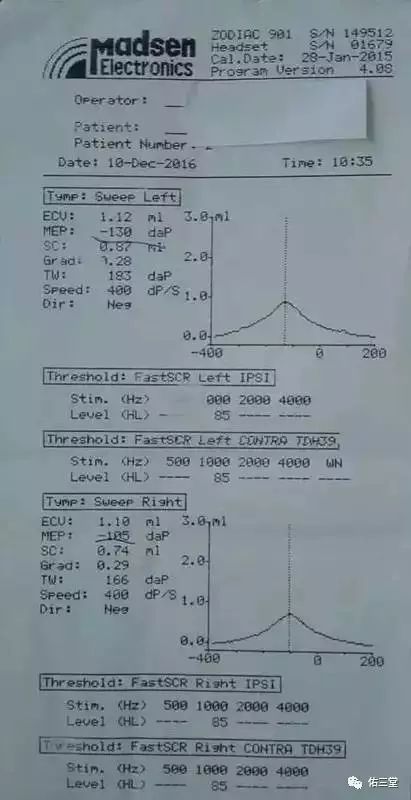 12月10日,我带孩子去医院做声导抗测试, 果然左耳耳压-130,右耳耳压