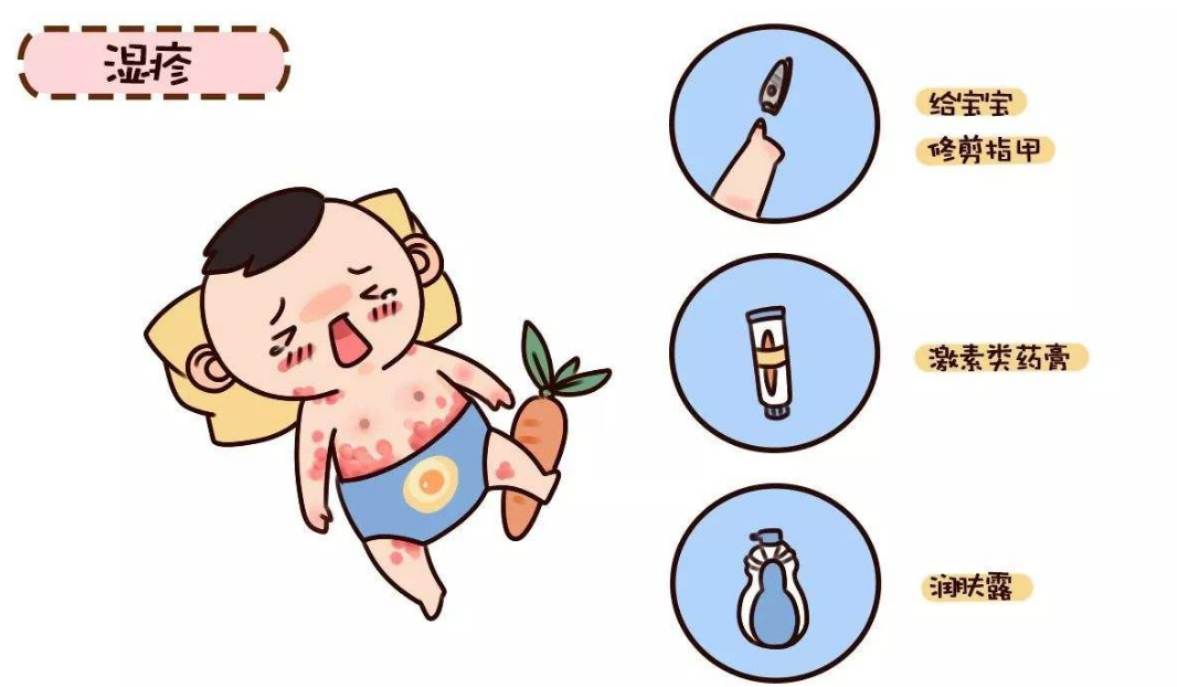                     原创            「别错过」五种常见的新生儿疾病及预防方法，很实用！