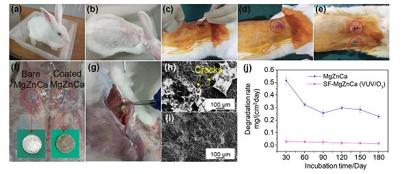 哈工大王晨曦&哈医大王岩松课题组acta biomaterialia