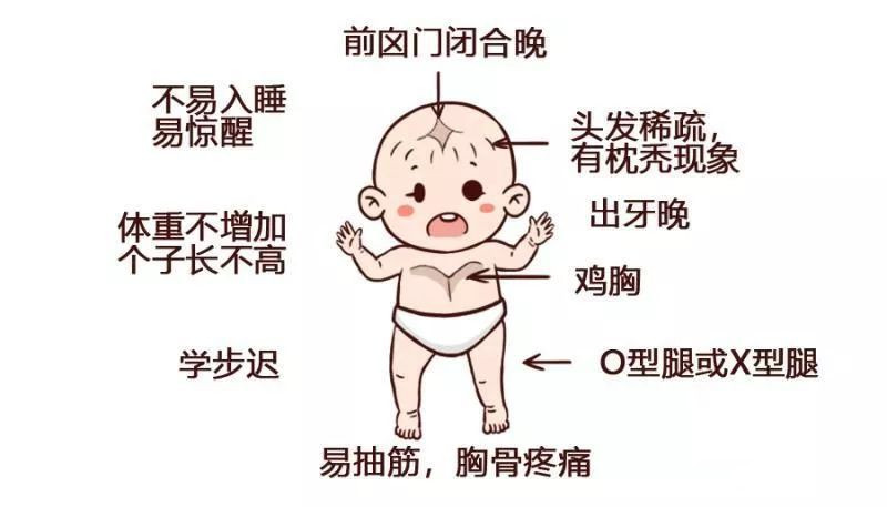 宝宝为什么会枕秃?枕秃就是缺钙吗?真正缺乏的可能是维生素d