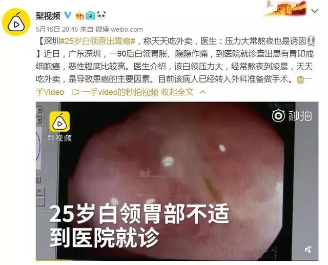 一般多久怀孕会出现恶心的现象 70df49c6fbe04beba136ebba82a468ba.jpeg