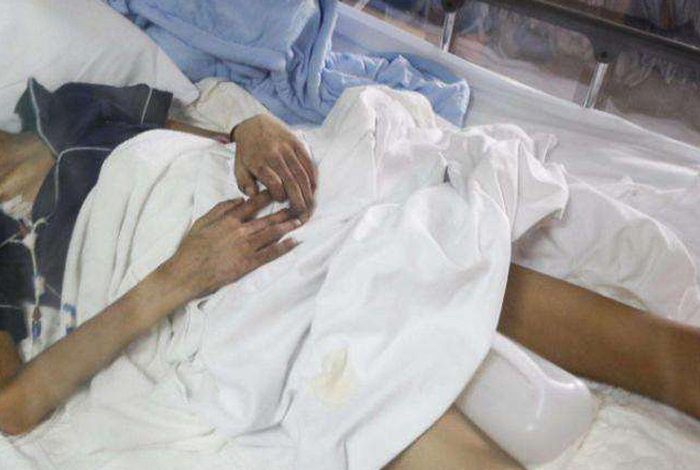                     原创            10岁男孩呕吐腹泻止不住，到医院检查后，才知道是儿童尿毒症